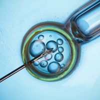 Inseminación Artificial