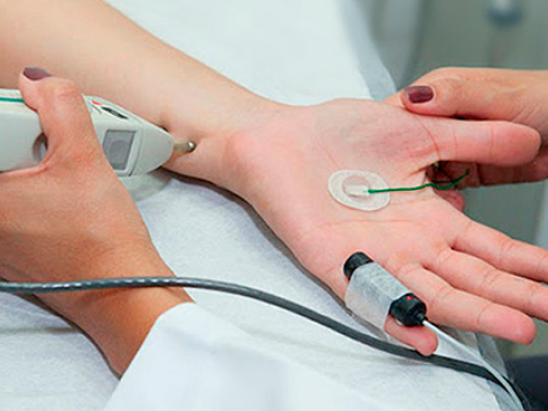 PRUEBA DE JOLLY Estimulación Repetitiva Supra Máxima
