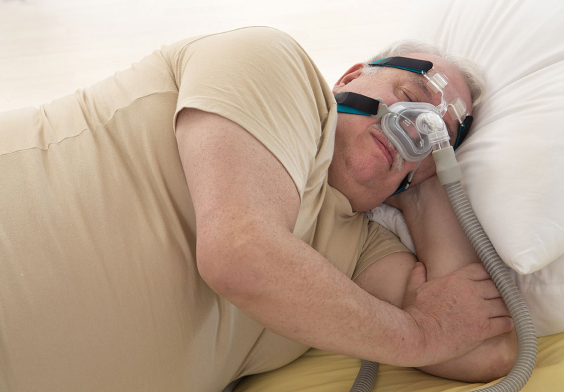 Síndrome de Obesidad e Hipoventilación
