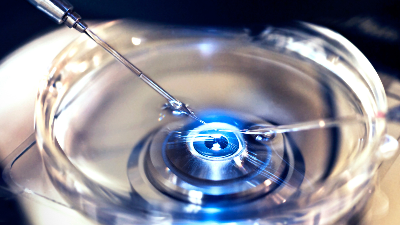 Fertilización in Vitro