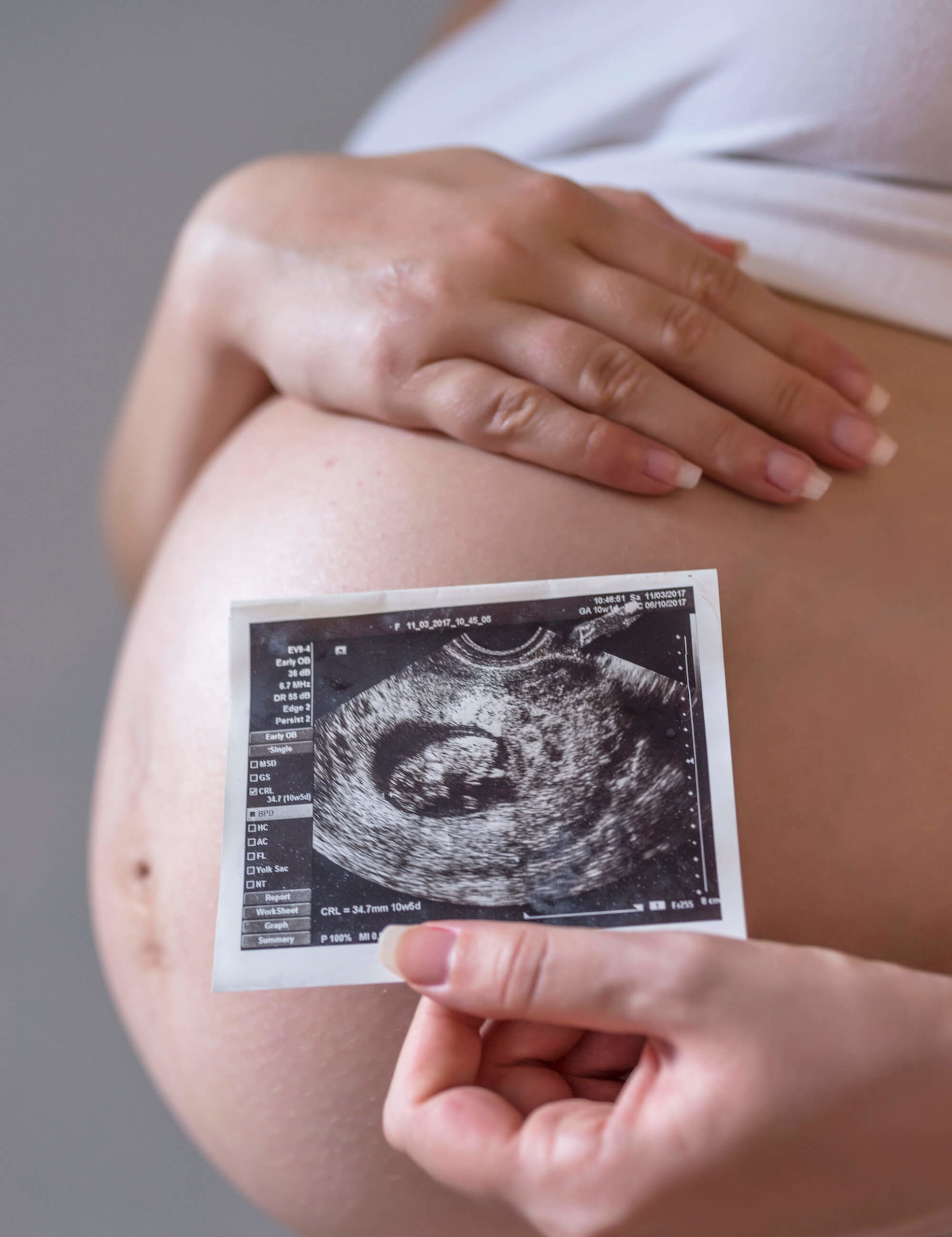 Unidad de Medicina Materno Fetal