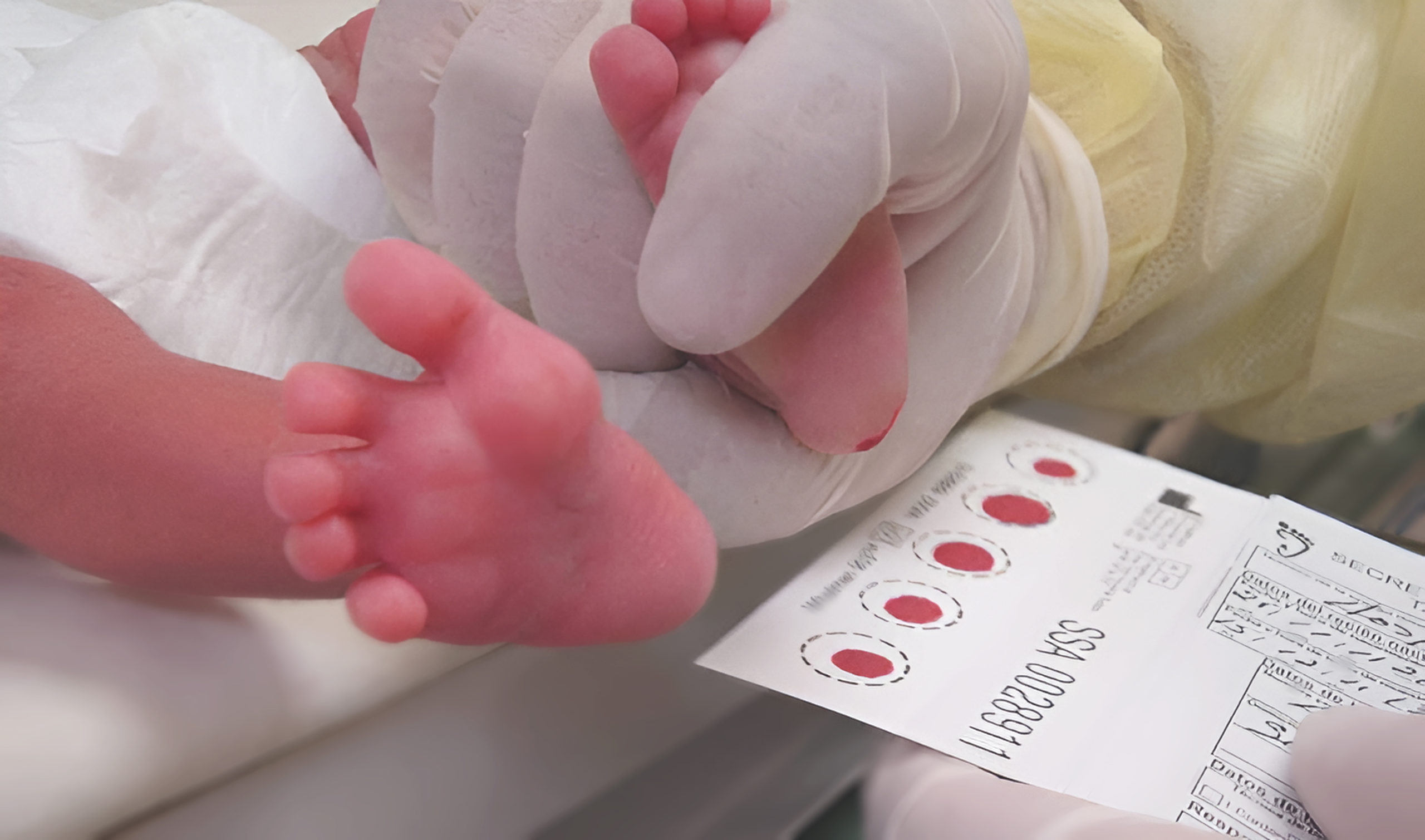 Tamiz Neonatal